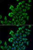 Signal Transduction Antibodies 3 Anti-FABP5 Antibody CAB6373
