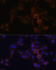 Cell Biology Antibodies 10 Anti-GRP Antibody CAB6380