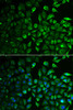 Cell Biology Antibodies 10 Anti-IMPA1 Antibody CAB6381