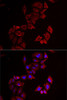 Cell Biology Antibodies 10 Anti-LIMS1 Antibody CAB6384