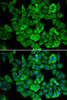 Metabolism Antibodies 2 Anti-OGDH Antibody CAB6391