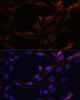 Cell Biology Antibodies 10 Anti-SERPINB9 Antibody CAB6393