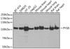 Metabolism Antibodies 2 Anti-PYGB Antibody CAB6402