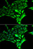 Metabolism Antibodies 2 Anti-PYGB Antibody CAB6402