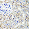 Cell Biology Antibodies 10 Anti-TNFAIP6 Antibody CAB6419