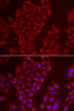 Cell Biology Antibodies 10 Anti-TPP2 Antibody CAB6421