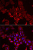 Cell Biology Antibodies 10 Anti-MYOT Antibody CAB6439