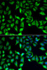 Cell Biology Antibodies 10 Anti-GDA Antibody CAB6441