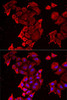 Cell Biology Antibodies 10 Anti-TIMM17A Antibody CAB6449