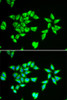 Cell Death Antibodies 2 Anti-PTRH2 Antibody CAB6466