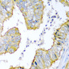 Cell Biology Antibodies 10 Anti-KRBOX4 Antibody CAB6471