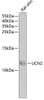 Cell Biology Antibodies 10 Anti-UCN2 Antibody CAB6485