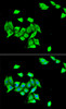 Cell Biology Antibodies 10 Anti-DNMT3A Antibody CAB6503