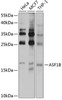 Developmental Biology Anti-ASF1B Antibody CAB6511