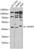 Cell Biology Antibodies 10 Anti-AKAP5 Antibody CAB6520