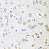 Cell Biology Antibodies 10 Anti-AKAP5 Antibody CAB6520
