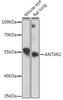 Cell Biology Antibodies 10 Anti-ANTXR2 Antibody CAB6526