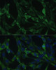Cell Biology Antibodies 10 Anti-CALU Antibody CAB6538