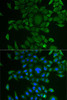 Cell Biology Antibodies 10 Anti-CCBL1 Antibody CAB6542