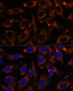 Cell Biology Antibodies 10 Anti-CCT3 Antibody CAB6547