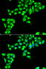 Cell Biology Antibodies 10 Anti-CLDN2 Antibody CAB6560