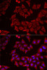 Metabolism Antibodies 2 Anti-CMPK1 Antibody CAB6561