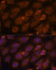 Cell Biology Antibodies 10 Anti-CREB3 Antibody CAB6567