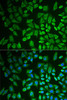 Epigenetics and Nuclear Signaling Antibodies 4 Anti-DDX41 Antibody CAB6576