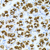 Cell Biology Antibodies 10 Anti-DLK1 Antibody CAB6578