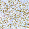 Cell Biology Antibodies 10 Anti-DLK1 Antibody CAB6578