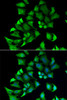 Cell Biology Antibodies 10 Anti-ENTPD2 Antibody CAB6584