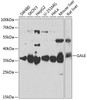 Metabolism Antibodies 2 Anti-GALE Antibody CAB6595