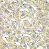 Cell Biology Antibodies 10 Anti-GLUD2 Antibody CAB6604