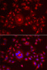 Cell Biology Antibodies 10 Anti-GORASP1 Antibody CAB6609