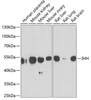Cell Biology Antibodies 10 Anti-IHH Antibody CAB6626