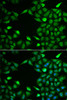 Cell Biology Antibodies 10 Anti-INTS6 Antibody CAB6634