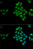 Signal Transduction Antibodies 3 Anti-KLK4 Antibody CAB6642