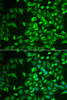 Signal Transduction Antibodies 3 Anti-LRAT Antibody CAB6647