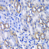 Cell Biology Antibodies 10 Anti-MATK Antibody CAB6651