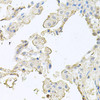 Cell Biology Antibodies 10 Anti-MMRN1 Antibody CAB6658