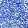 Cell Biology Antibodies 10 Anti-MTA3 Antibody CAB6660