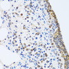 Cell Biology Antibodies 10 Anti-MTA3 Antibody CAB6660