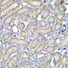 Cardiovascular Antibodies Anti-PDCD6 Antibody CAB6685
