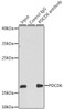 Cardiovascular Antibodies Anti-PDCD6 Antibody CAB6685