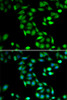 Cardiovascular Antibodies Anti-PDCD6 Antibody CAB6685