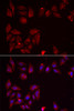 Cell Biology Antibodies 10 Anti-PDXK Antibody CAB6687