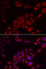 Cell Biology Antibodies 10 Anti-PIKFYVE Antibody CAB6689