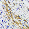 Metabolism Antibodies 2 Anti-PLA2G2D Antibody CAB6690