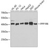 Epigenetics and Nuclear Signaling Antibodies 4 Anti-PPP1R8 Antibody CAB6701