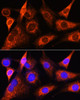 Metabolism Antibodies 2 Anti-PSAT1 Antibody CAB6707